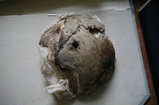 堅硬的頭骨_第七顆頭骨_希特勒頭骨